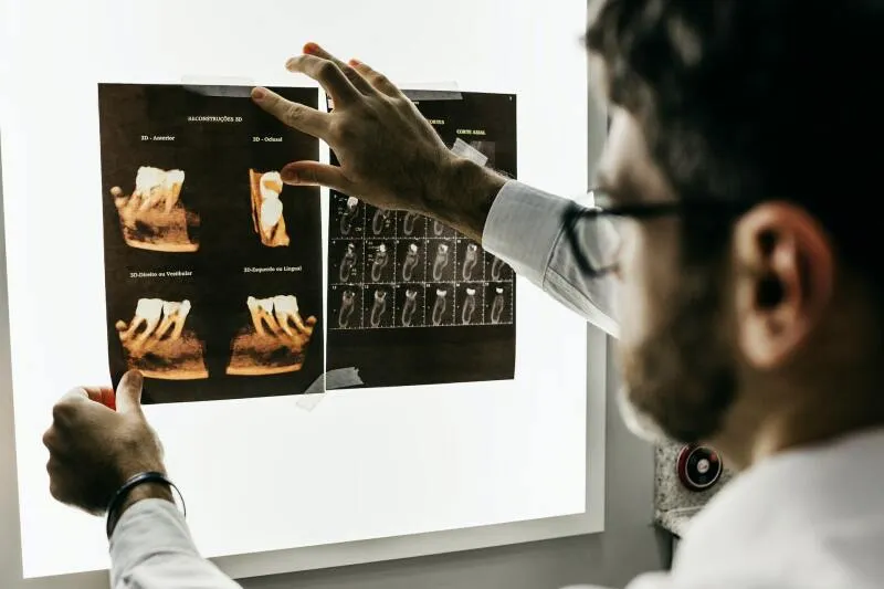 W jakim celu wykonuje się skanowanie 3D zębów? Zastosowanie, zalety i przebieg badania